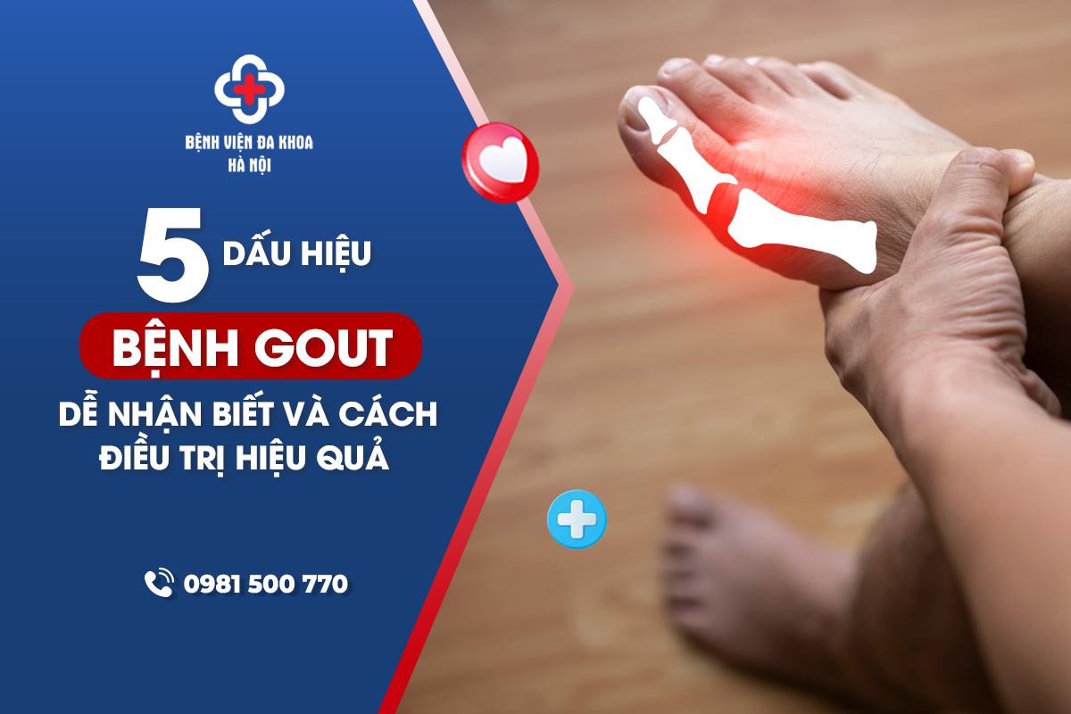 5 Dấu Hiệu Bệnh Gout Dễ Nhận Biết và Cách Điều Trị Hiệu Quả
