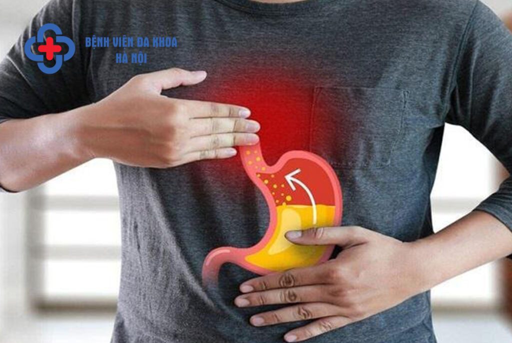 trào ngược axit dạ dày