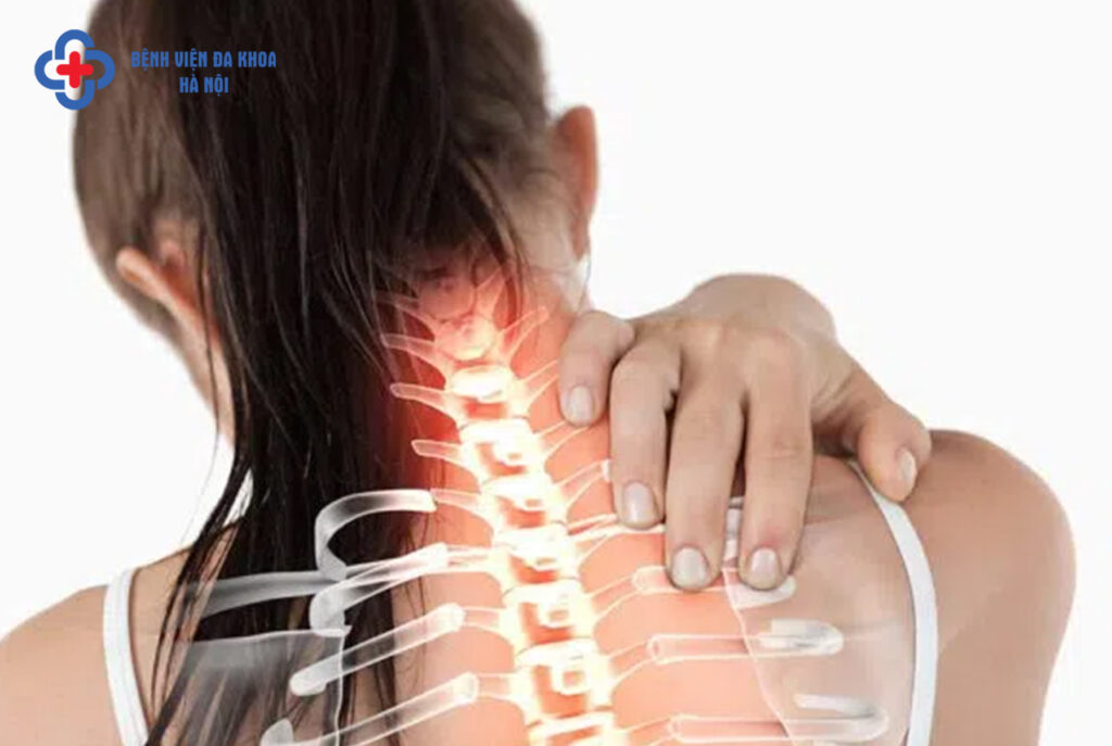 gai đốt sống cổ