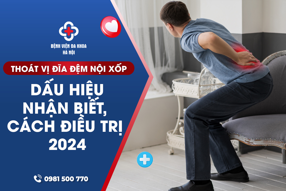 Thoát Vị Đĩa Đệm Nội Xốp: Dấu Hiệu Nhận Biết, Cách Điều Trị 2024