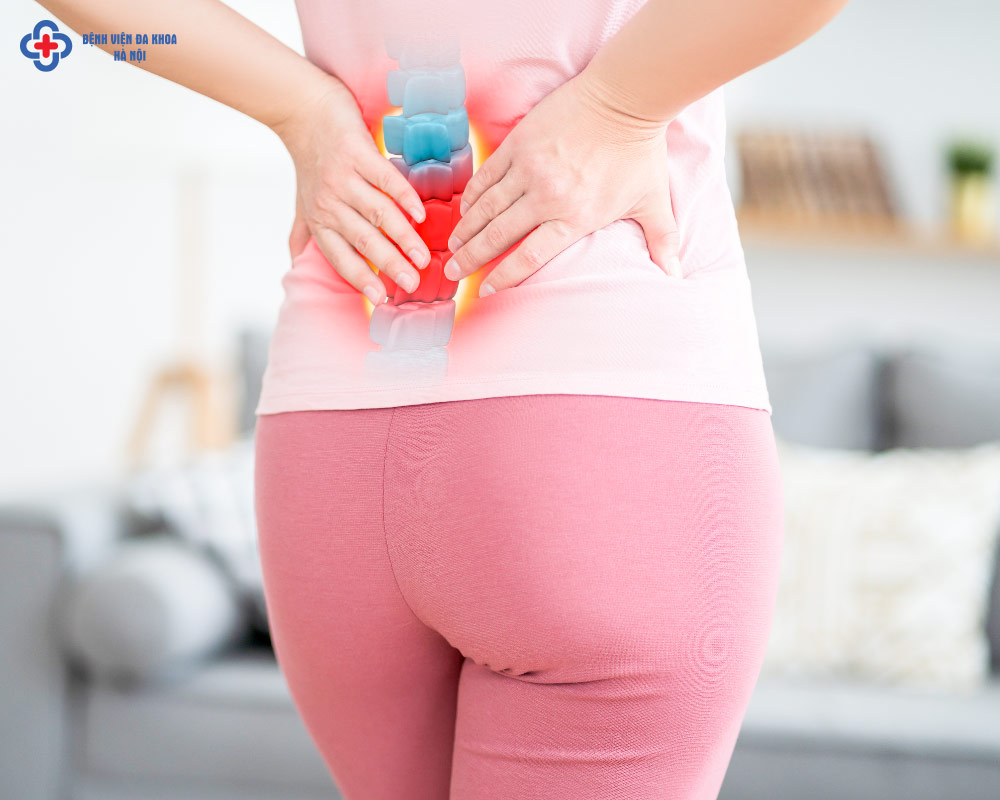 Thoát vị đĩa đệm nội xốp là gì?