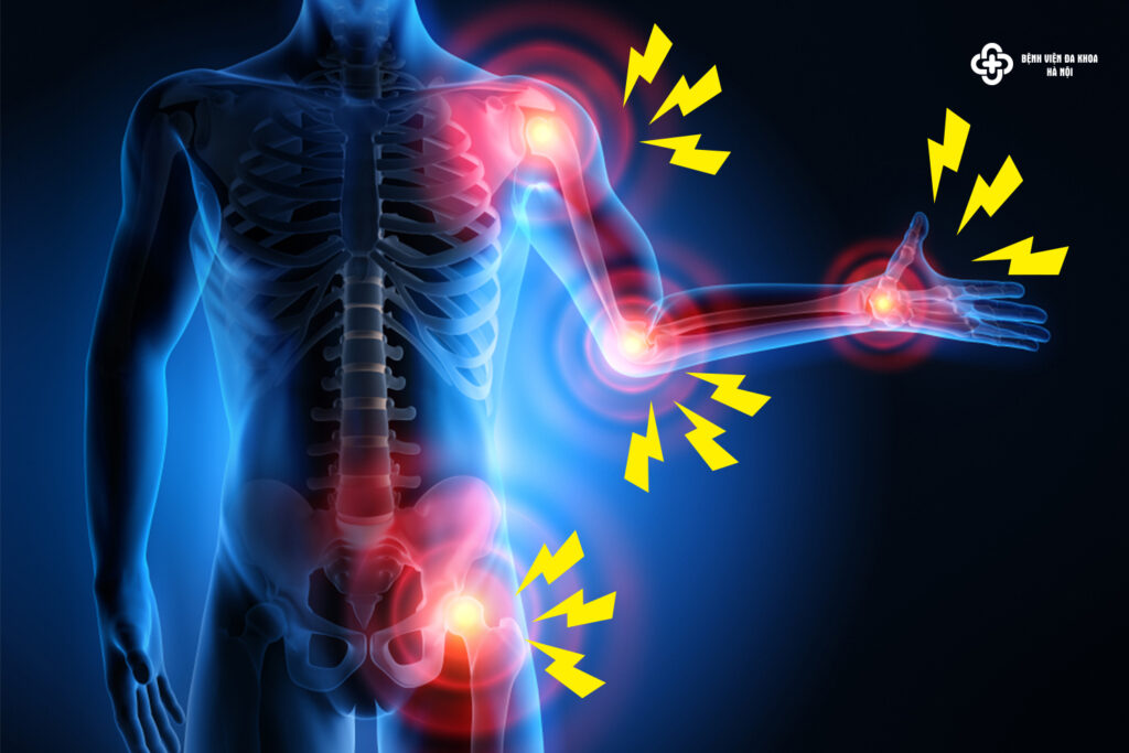 Xương khớp kêu khi vận động có nguy hiểm không?