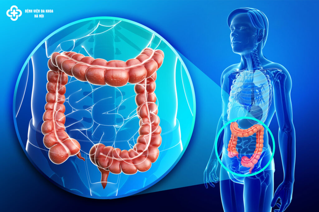 vì sao cần làm sạch đại tràng trước khi nội soi