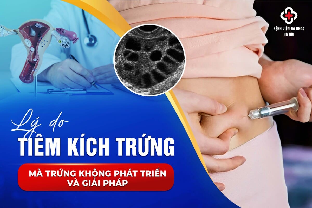 Lý do tiêm kích trứng mà trứng không phát triển và giải pháp