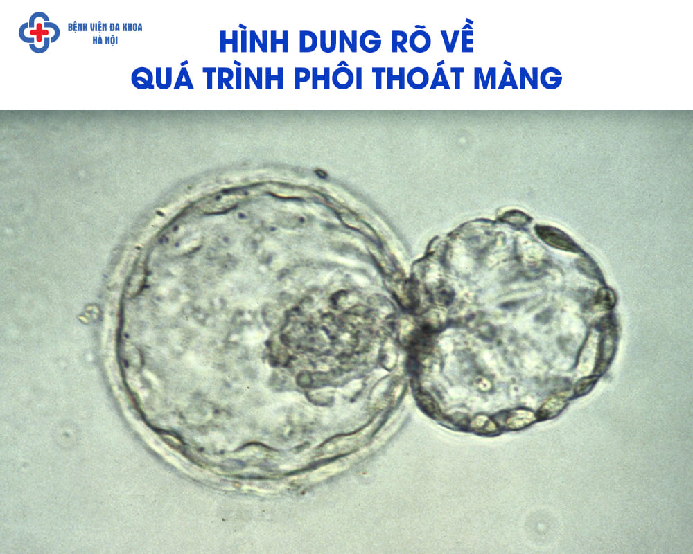Minh hoạ hình ảnh phôi thoát màng