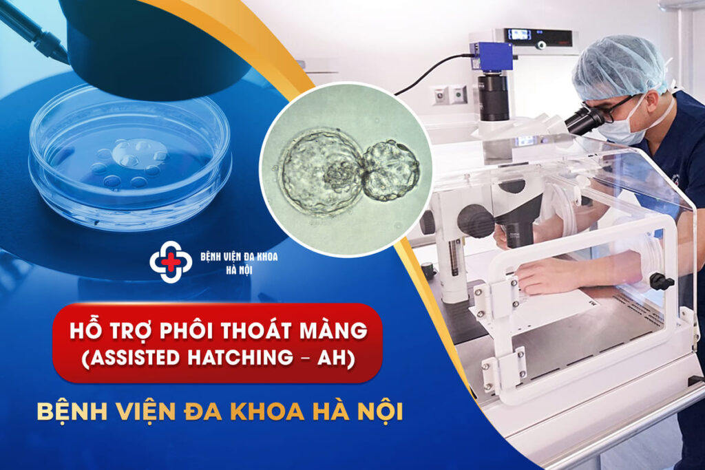 Hỗ Trợ Phôi Thoát Màng (Assisted Hatching – AH)
