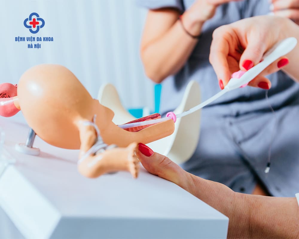 Quy trình bơm IUI chuyên nghiệp tại Bệnh viện Đa khoa Hà Nội