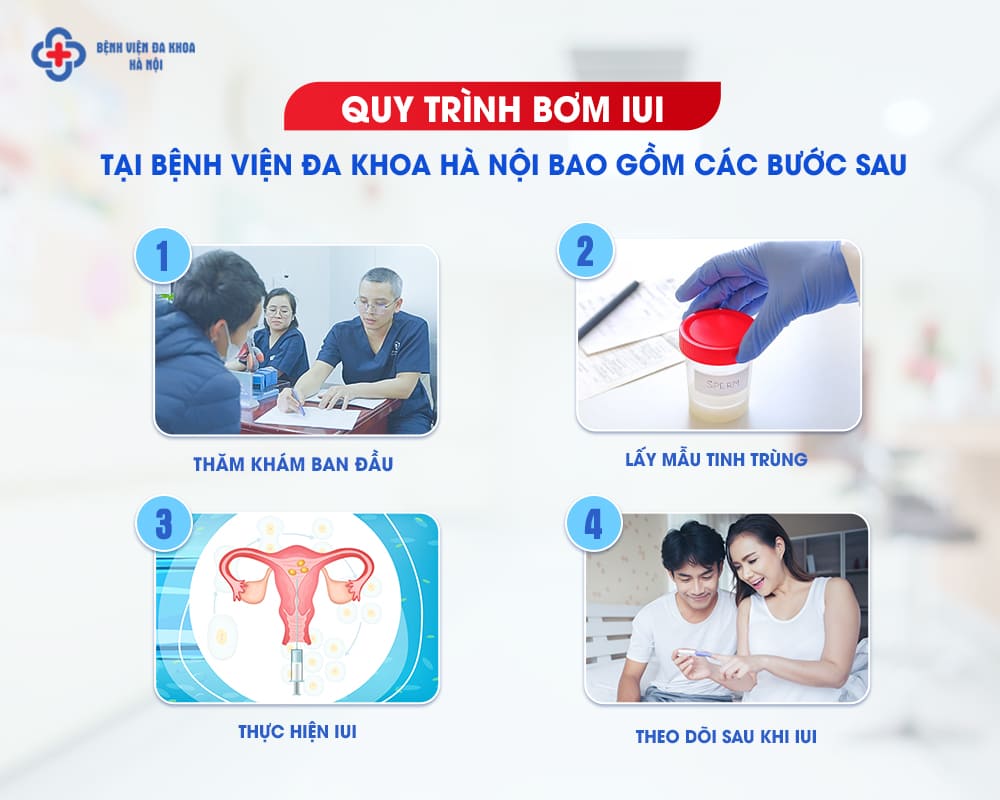 Quy trình bơm IUI chuyên nghiệp tại Bệnh viện Đa khoa Hà Nội