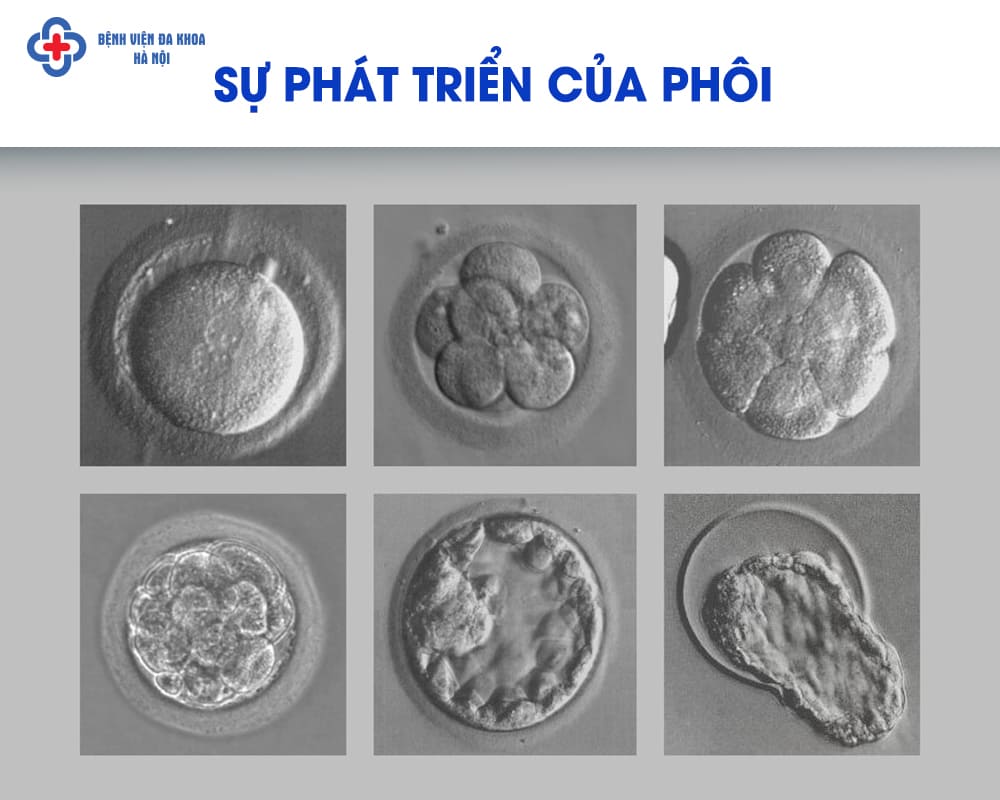Sự phát triển của phôi trong phòng Lab