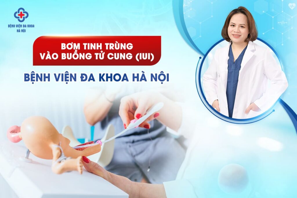 Bơm Tinh Trùng Vào Buồng Tử Cung (IUI) | Bệnh Viện Đa Khoa Hà Nội
