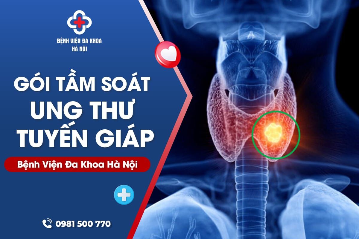 Gói tầm soát ung thư tuyến giáp - Bệnh Viện Đa Khoa Hà Nội