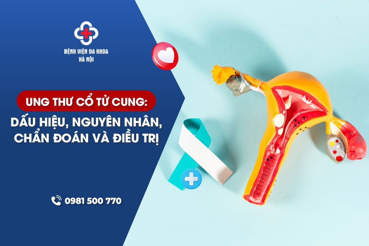 Ung Thư Cổ Tử Cung: Dấu Hiệu, Nguyên Nhân, Chẩn Đoán Và Điều Trị