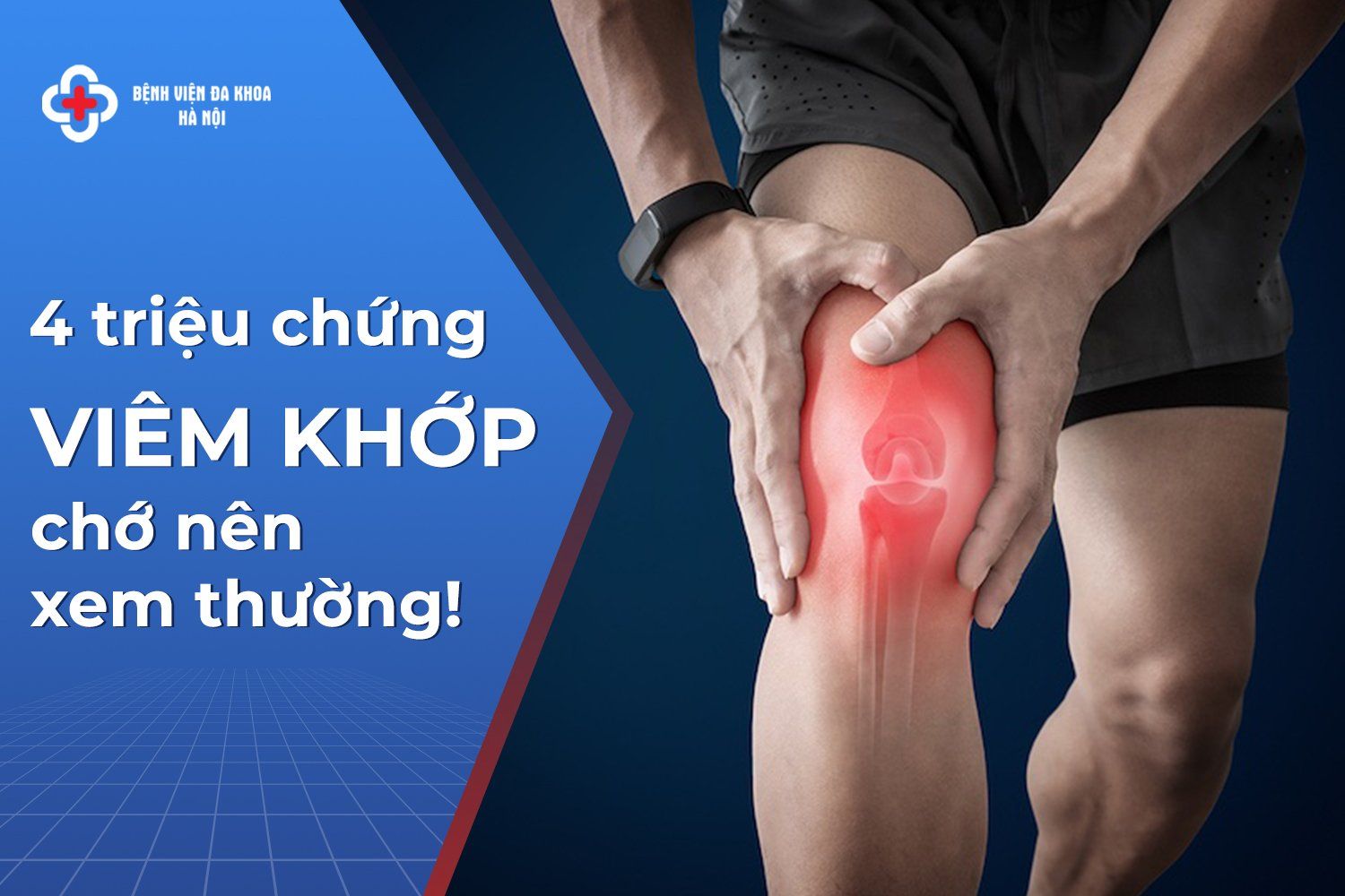 viem khop
