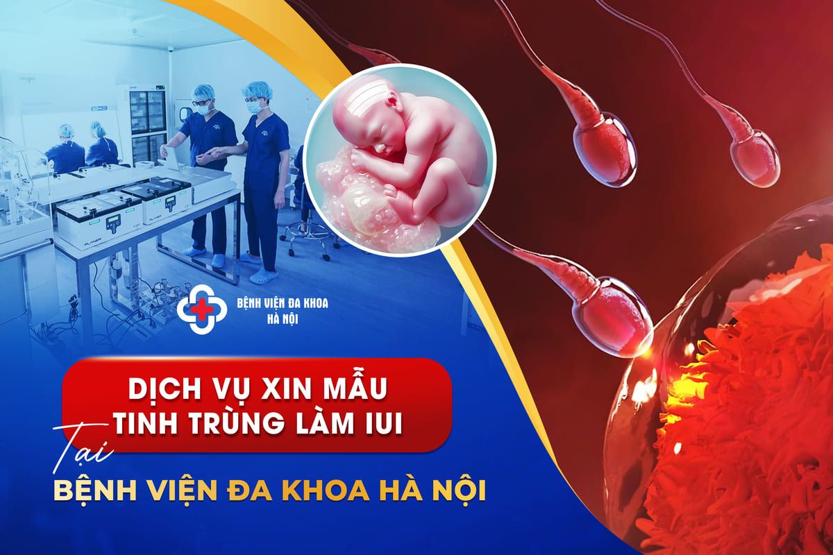 Dịch vụ xin mẫu tinh trùng làm IUI | Bệnh viện Đa khoa Hà Nội