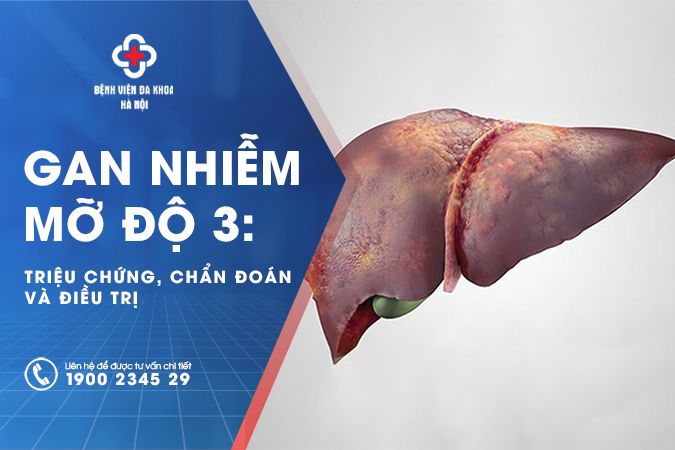 gan nhiễm mỡ