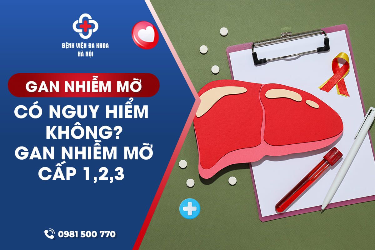 Gan Nhiễm Mỡ Có Nguy Hiểm Không? Gan Nhiễm Mỡ Cấp 1,2,3