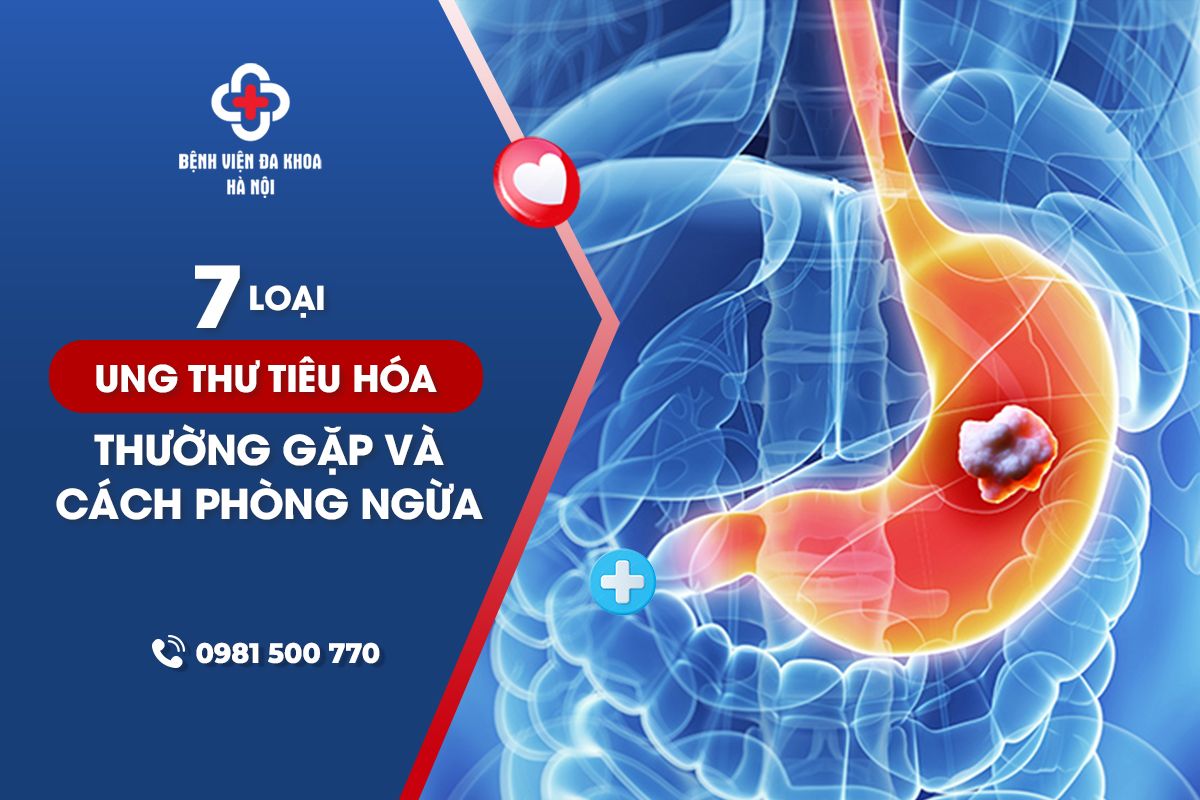 7 Loại Ung Thư Tiêu Hóa Thường Gặp Và Cách Phòng Ngừa