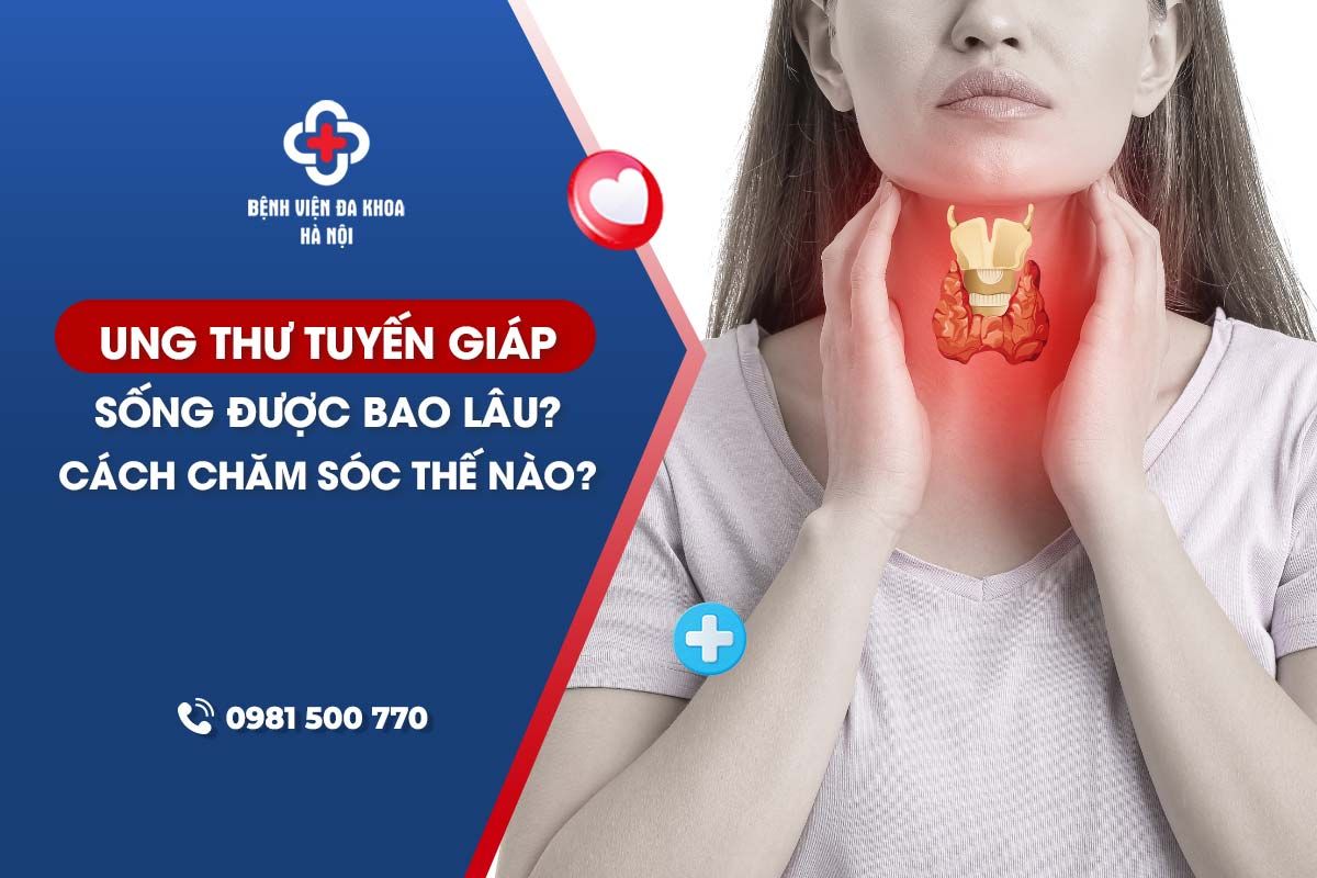 Ung thư tuyến giáp sống được bao lâu? Điều trị thế nào?