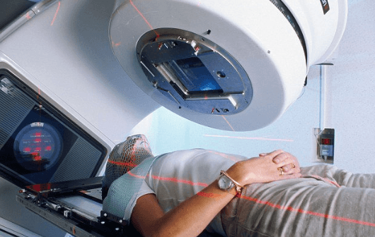 Xạ trị ngoài là một trong những nguyên nhân tăng nguy cơ ung thư phần mềm