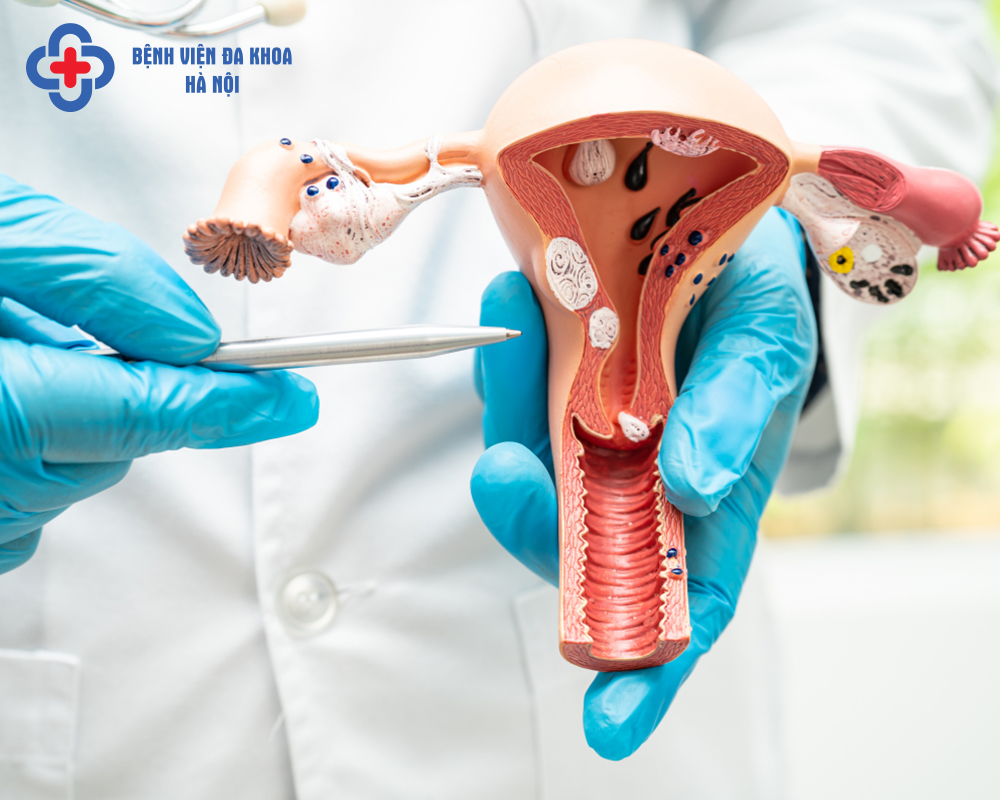 Ung thư cổ tử cung giai đoạn đầu là gì?