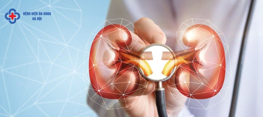 Tán sỏi ngược dòng là gì?