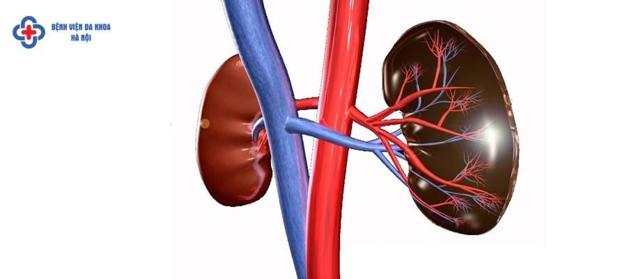 Tìm hiểu về bệnh thận Tìm hiểu về bệnh thận