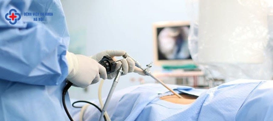 Tán sỏi thận là gì? Tán sỏi thận là gì?