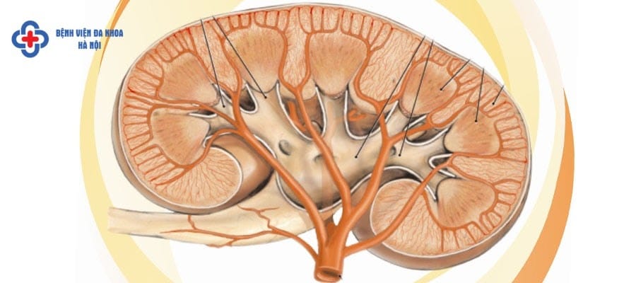 Cách trị sỏi thận hiệu quả nhất hiện nay Cách trị sỏi thận hiệu quả nhất hiện nay