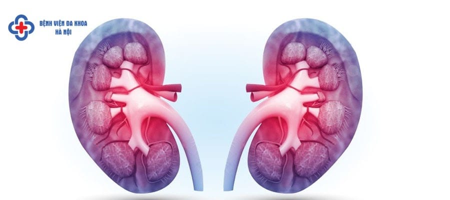 Tán sỏi ngoài cơ thể không phù hợp với người có sỏi to Tán sỏi ngoài cơ thể không phù hợp với người có sỏi to