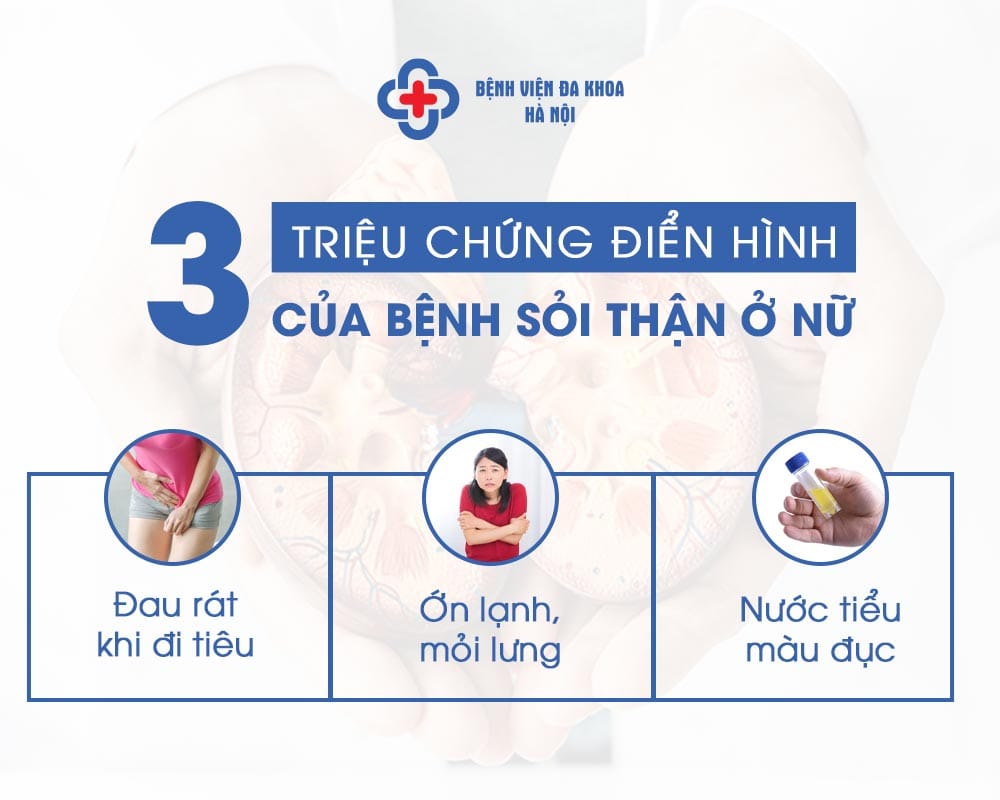 Triệu chứng sỏi thận ở phụ nữ