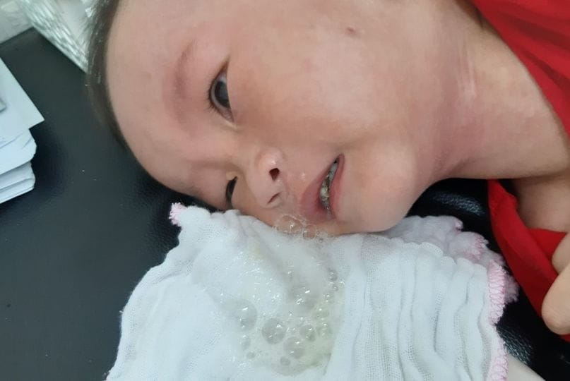 Vai trò của vỗ rung trong điều trị bệnh hô hấp ở trẻ ho có đờm