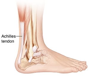 Triệu chứng và dấu hiệu vỡ gân Achilles Ảnh giải phẫu gân gót Achilles