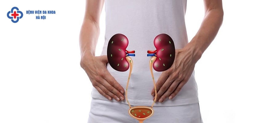 Dấu hiệu gây bệnh viêm đường tiết niệu Dấu hiệu gây bệnh viêm đường tiết niệu