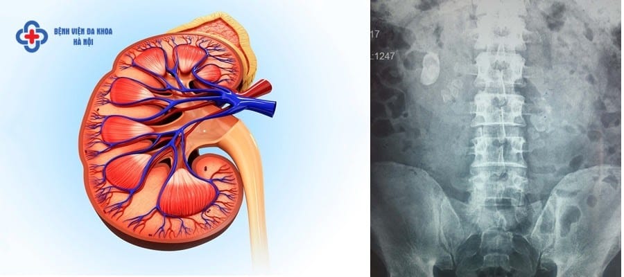Khám thận ở bệnh viện nào tốt nhất Hà Nội? Khám thận ở bệnh viện nào tốt nhất Hà Nội?
