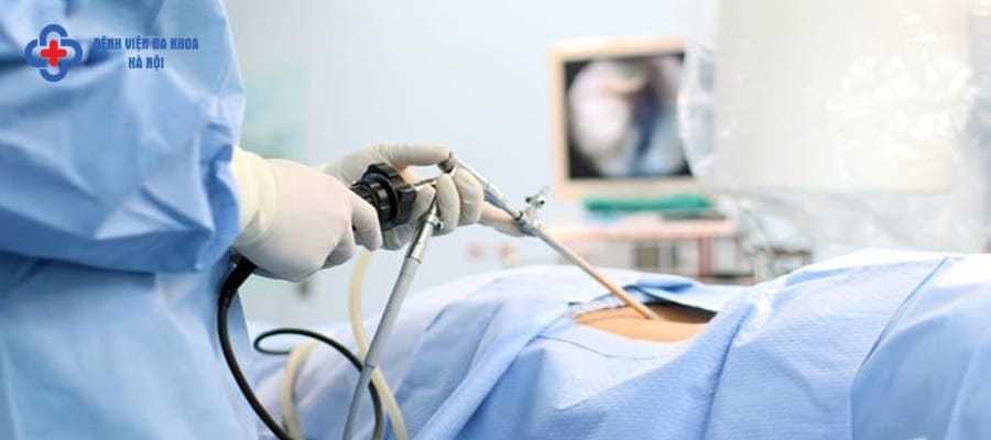 Mức chi phí mổ nội soi sỏi niệu quản Mức chi phí mổ nội soi sỏi niệu quản