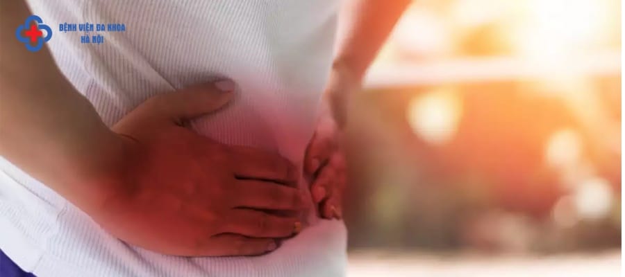 Càng ngày càng có nhiều ca mắc sỏi thận Càng ngày càng có nhiều ca mắc sỏi thận