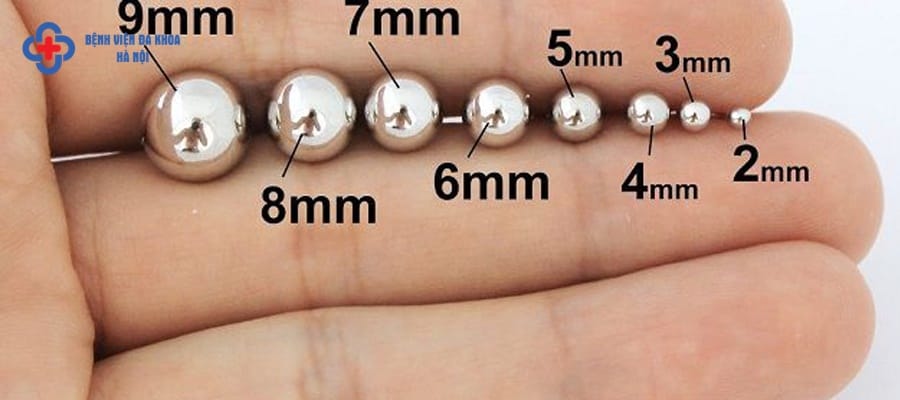 Bị sỏi thận 6mm có phải mổ không? Bị sỏi thận 6mm có phải mổ không?