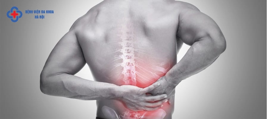 Một số triệu chứng bệnh sỏi thận Một số triệu chứng bệnh sỏi thận