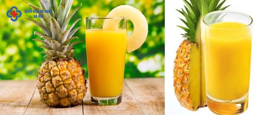 Hạn chế thực phẩm giàu axit như chanh, dứa Hạn chế thực phẩm giàu axit như chanh, dứa