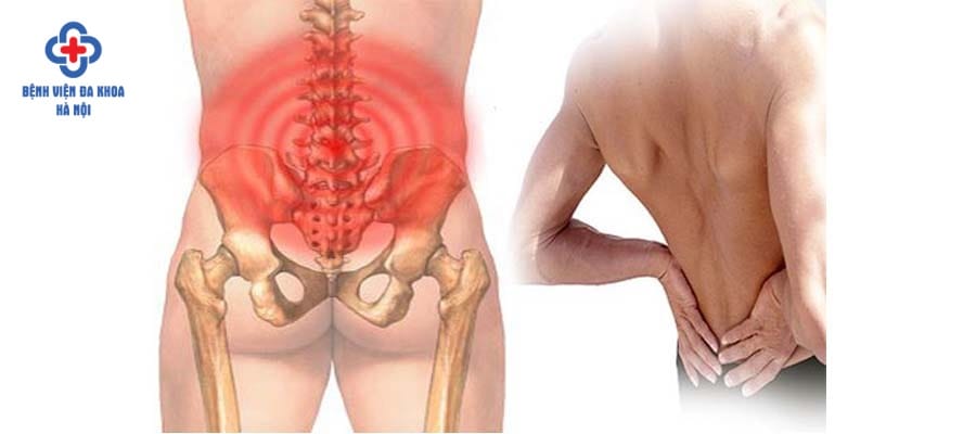 Biến chứng điển hình của sỏi niệu quản