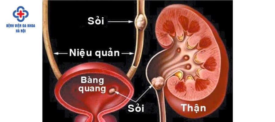 Điều trị bệnh sớm để tránh các biến chứng nguy hiểm