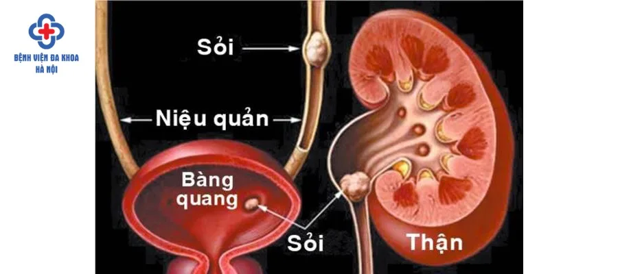 Điều trị bệnh sớm để tránh các biến chứng nguy hiểm