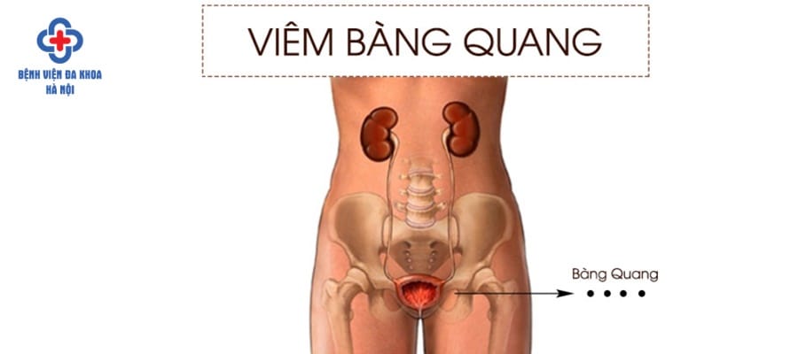 Bệnh có thể gây nên nhiều biến chứng