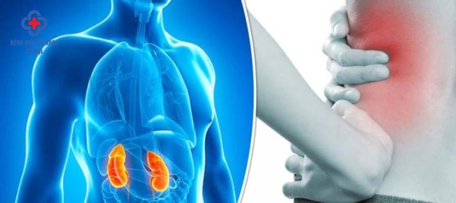 Sỏi thận có thể gây ra các cơn đau quặn, đau dữ dội