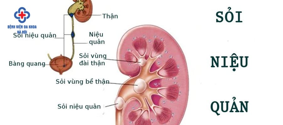 bi soi nieu quan nen an gi