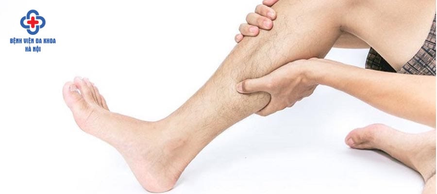 Tắc mạch chi có thể gây hoại tử nếu không can thiệp sớm tac mach chi