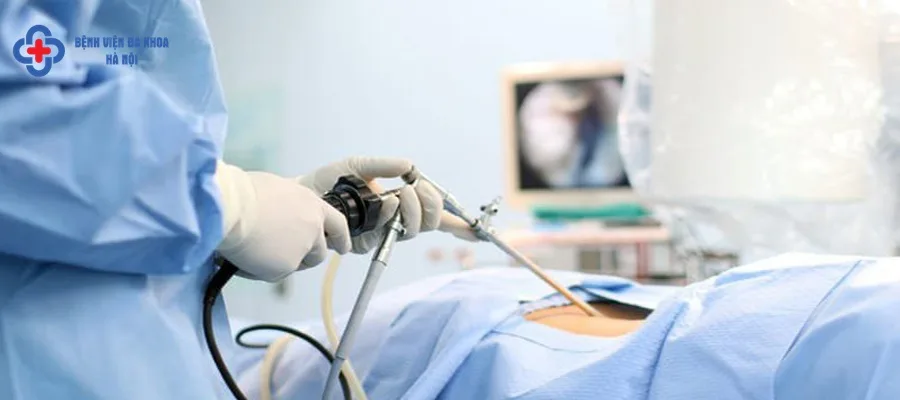 Tán sỏi qua da, giảm biến chứng, tăng hiệu quả điều trị benh soi than va cach dieu tri