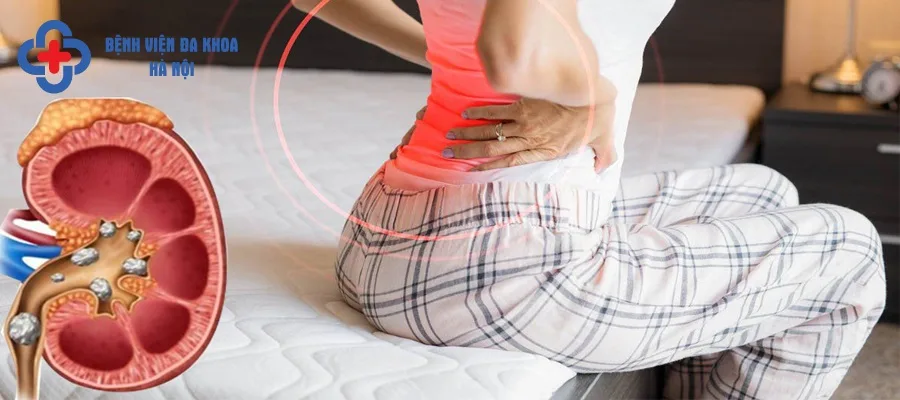 Chất khoáng lắng đọng lâu ngày tạo thành sỏi