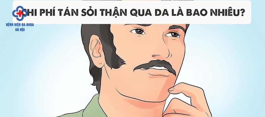 Nhiều bệnh nhân băn khoăn về chi phí tán sỏi