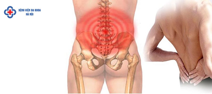 Ảnh hưởng đến sinh hoạt, cuộc sống, sức khỏe của người bệnh cơn đau quặn thận do sỏi thận